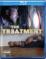 The Treatment (Blu-ray Movie)