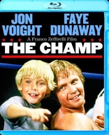 The Champ (Blu-ray Movie), temporary cover art