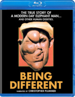 Being Different (Blu-ray Movie)